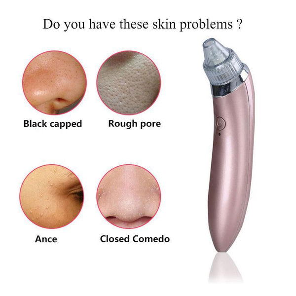 Electric Blackhead Remover